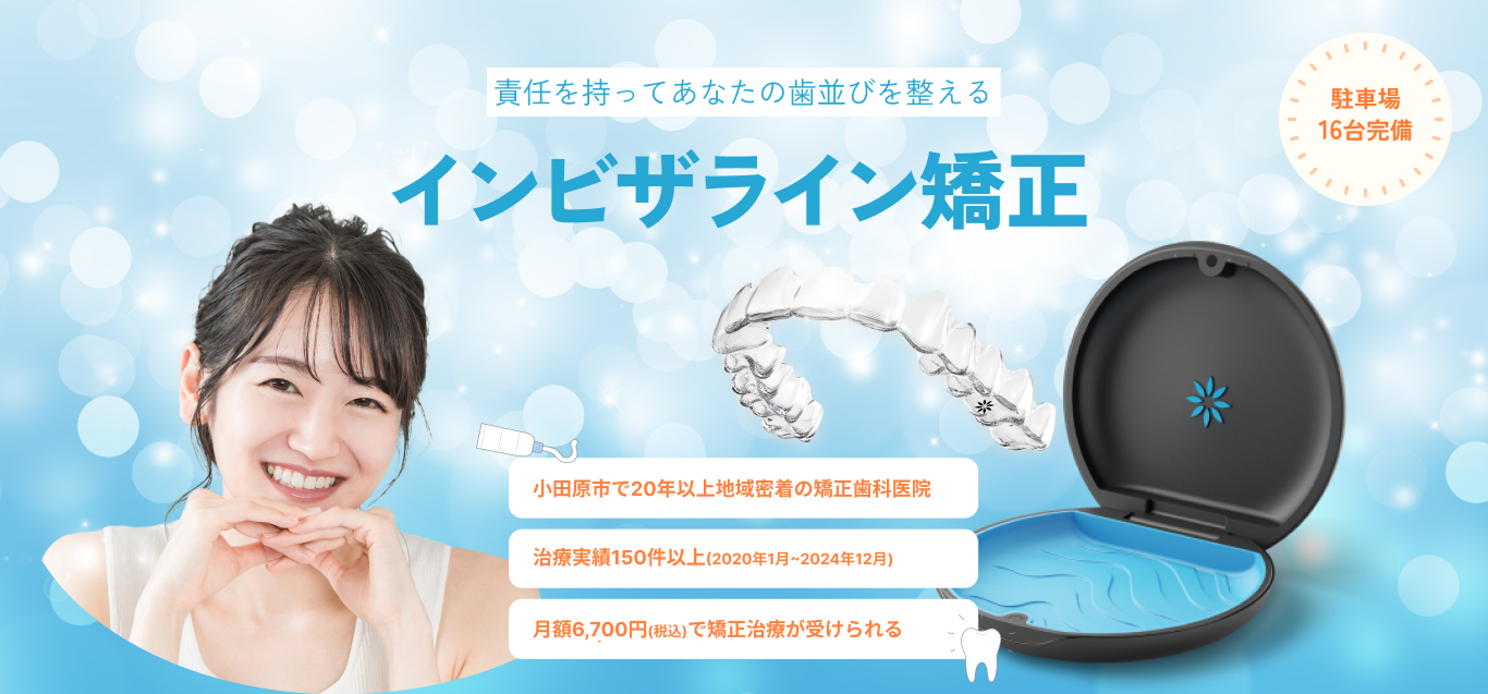 こっそり綺麗な歯を手に入れるマウスピース矯正(インビザライン)